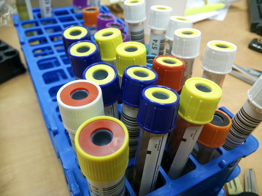 Blood test samples