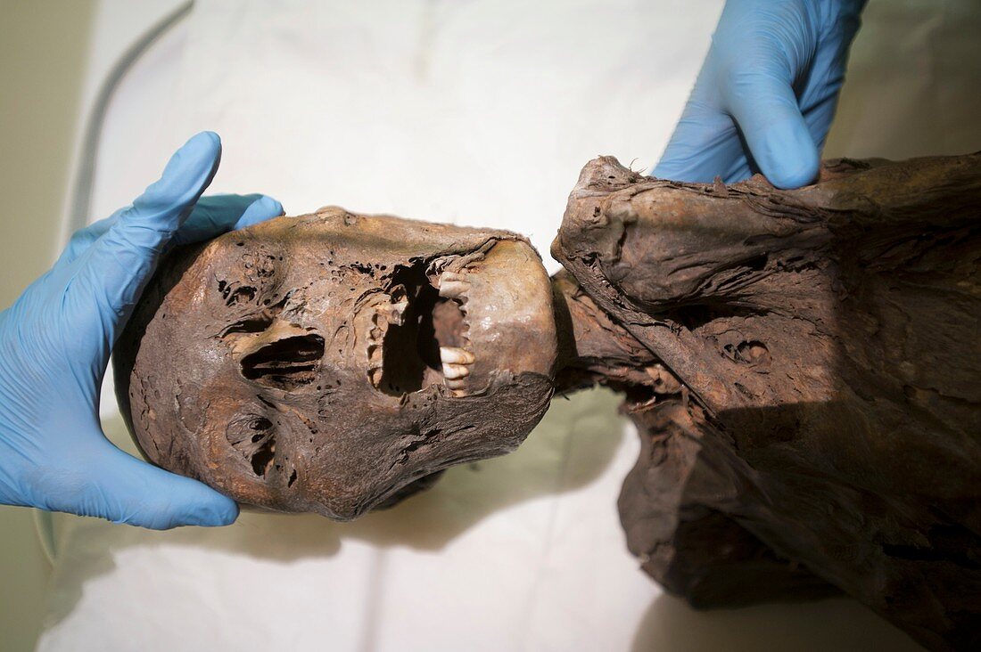 Peruvian mummy, X-ray research