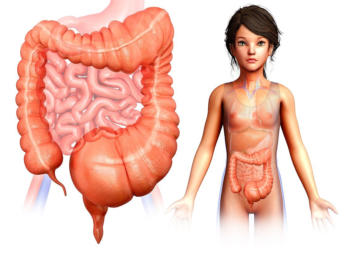 Child with mega colon, illustration