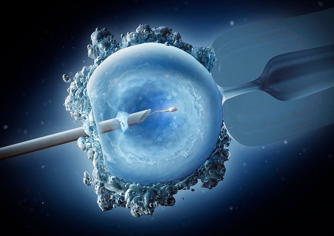 ICSI in vitro fertilisation, illustration