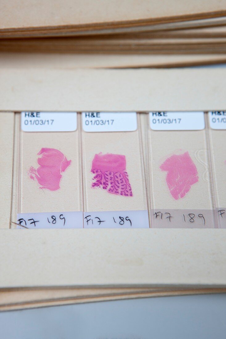Dyed brain and tissue specimens