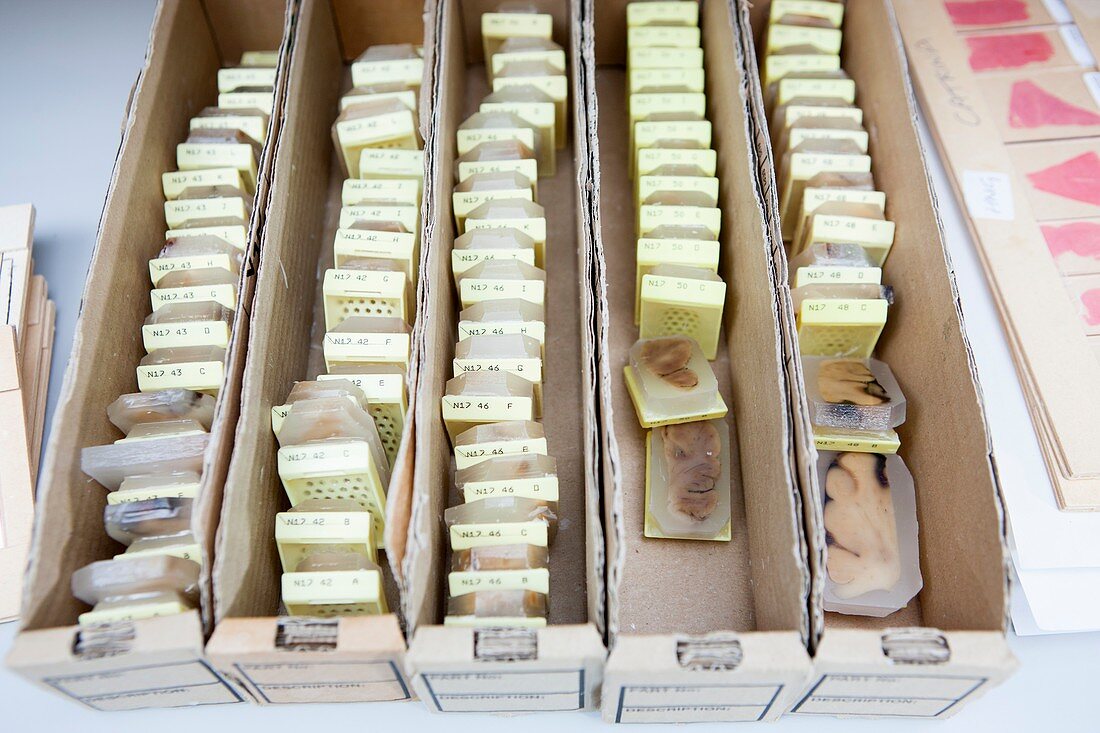 Tissue specimens, wax blocks