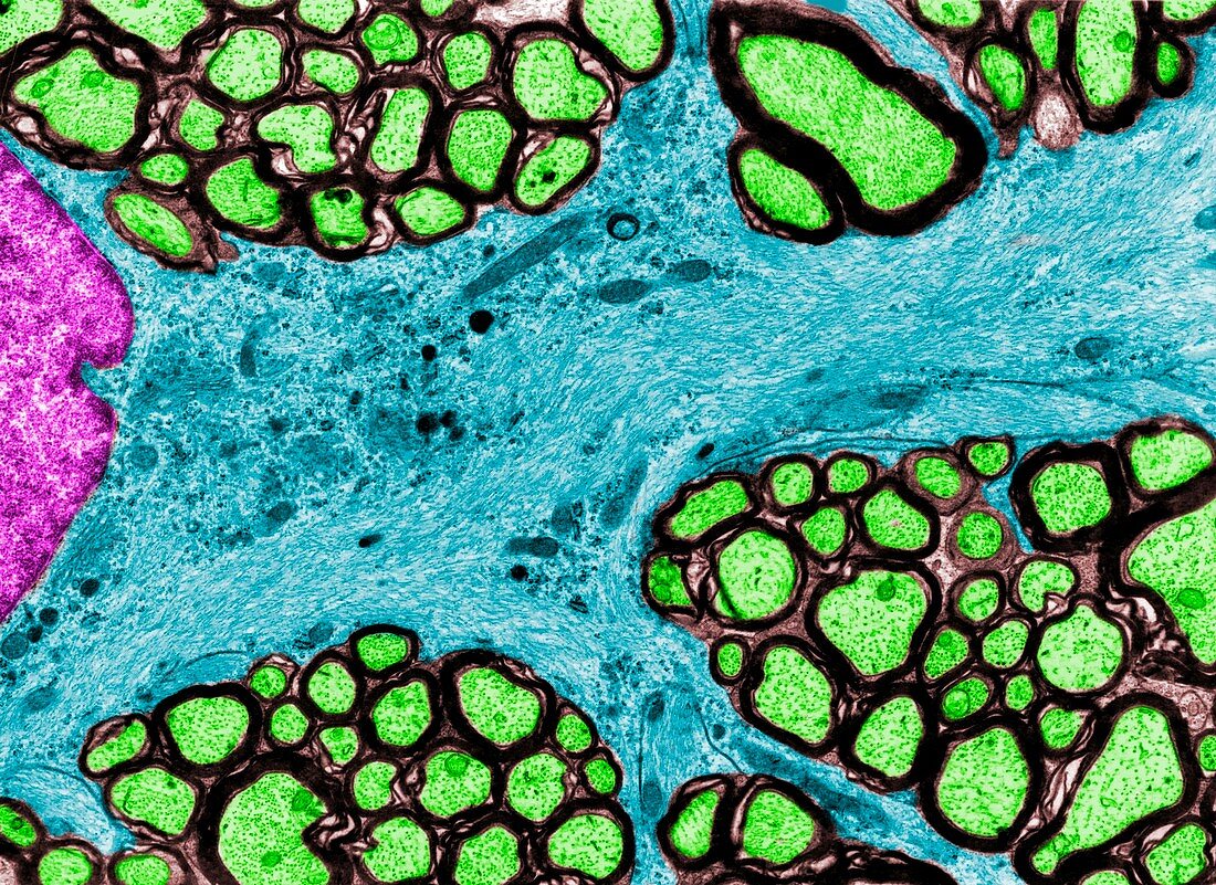 Fibrous astrocyte cytoplasm, TEM