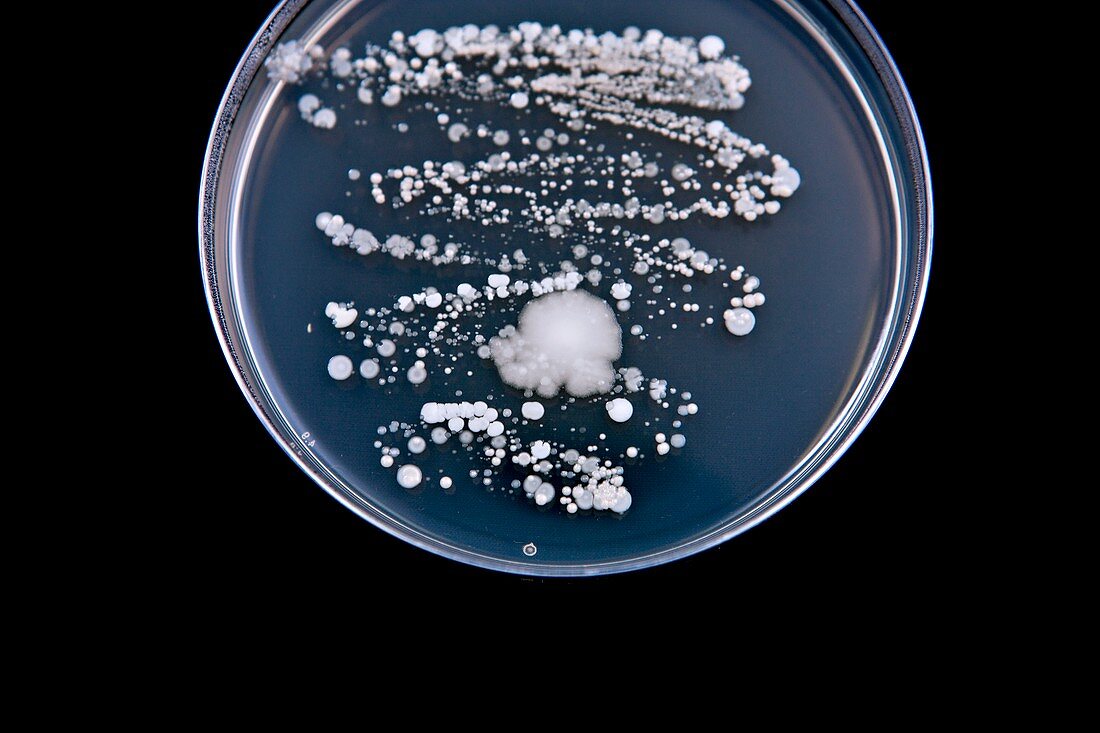 Nose bacteria culture