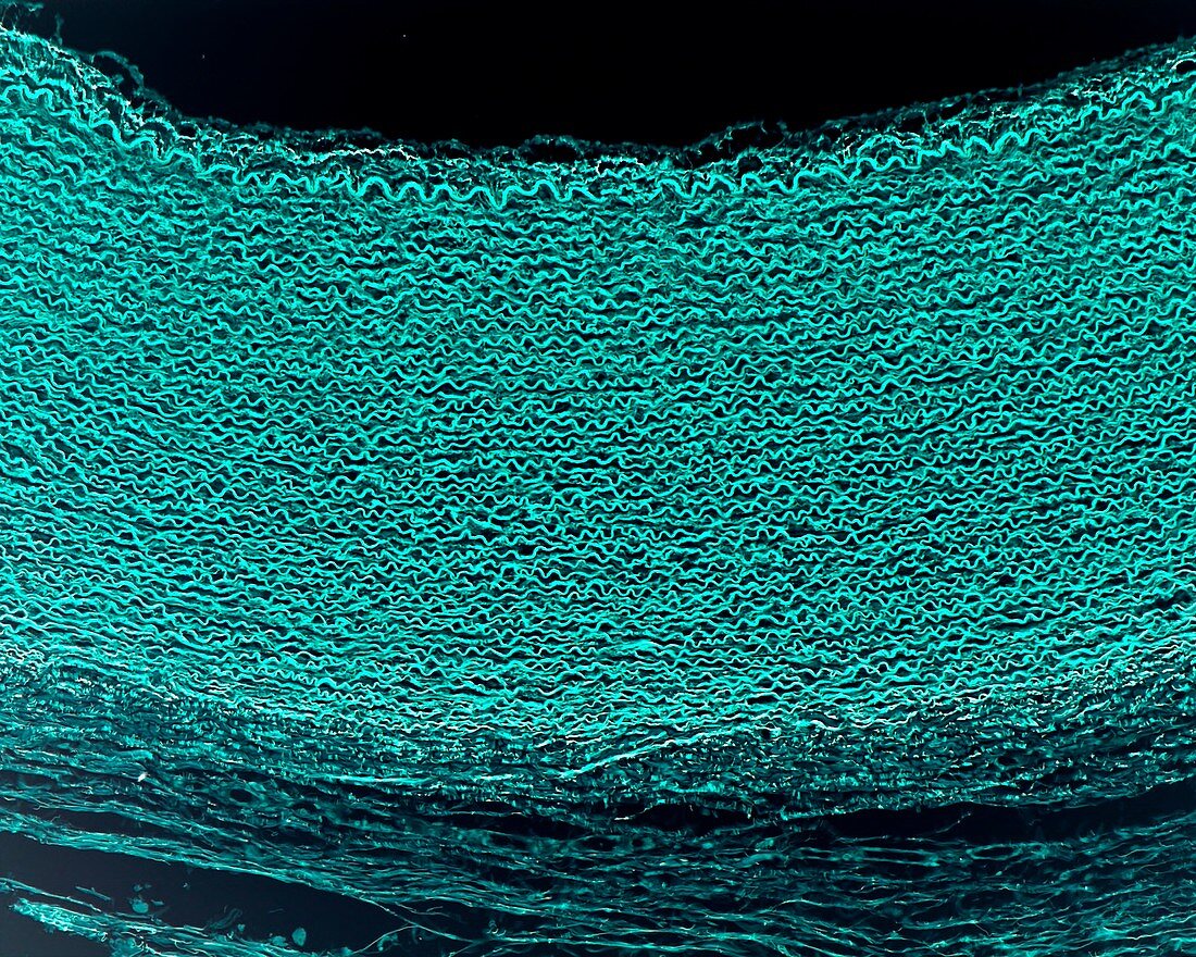 Wall of an elastic artery, light micrograph
