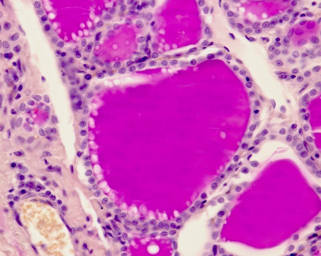 Thyroid gland, light micrograph