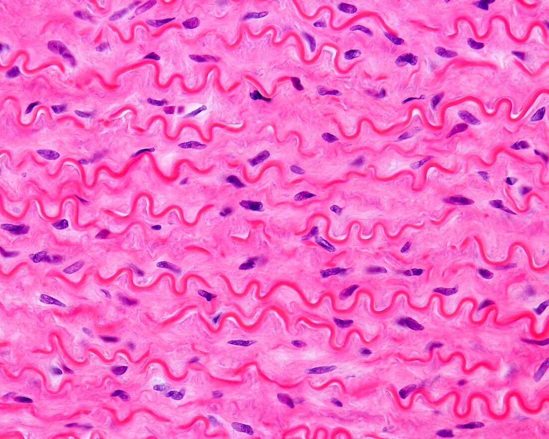 Aorta, light micrograph