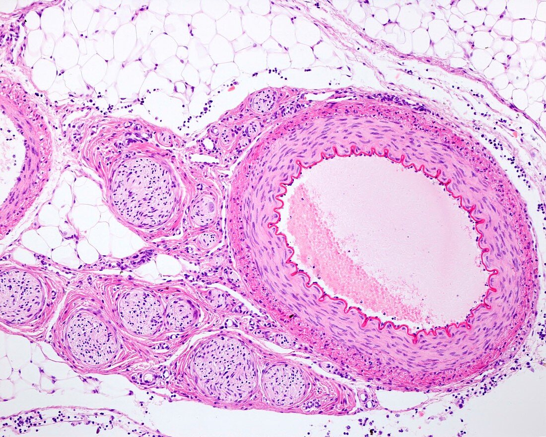 Muscular artery and nerves, light micrograph