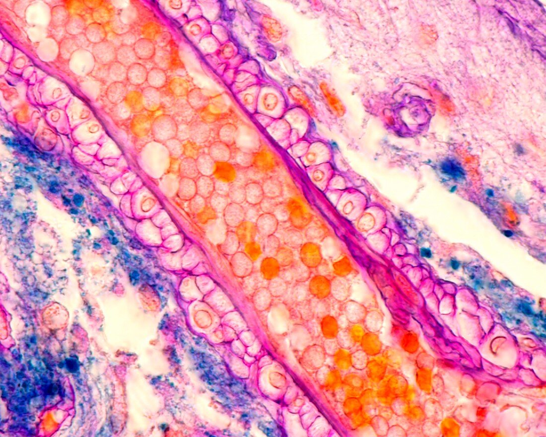 Arteriole smooth muscle cells, light micrograph