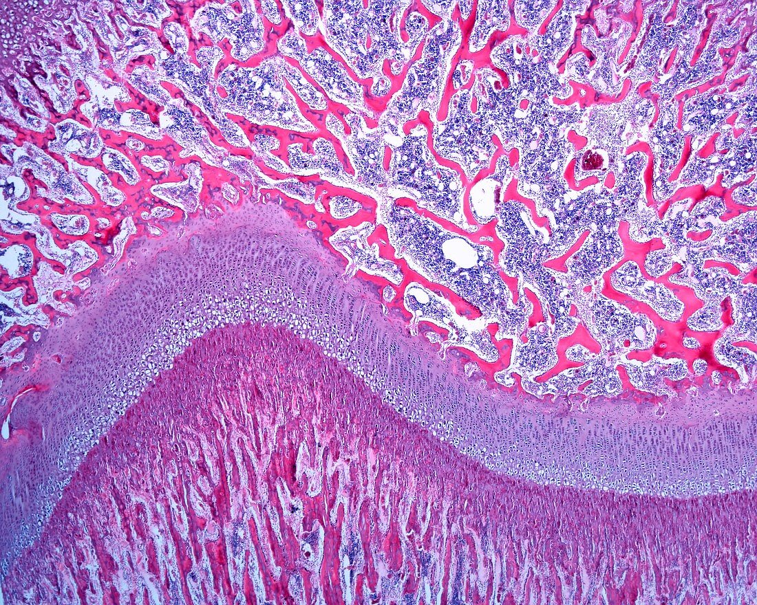 Bone growth plate, light micrograph