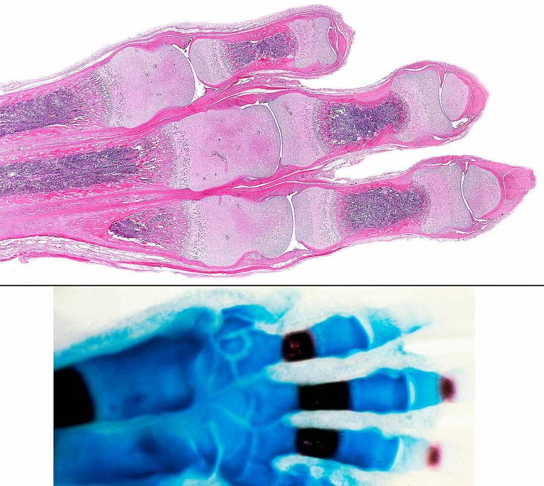 Ossification of hand bones, light micrographs