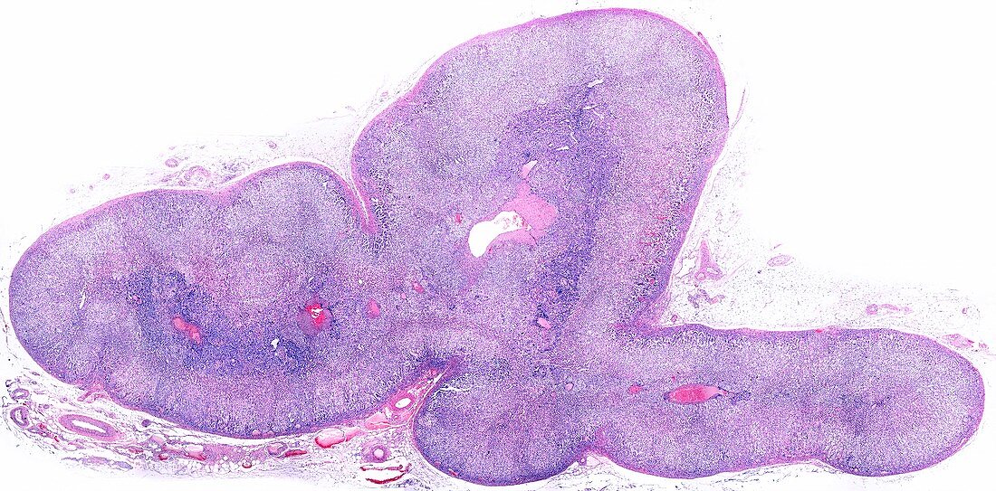 Human adrenal gland, light micrograph