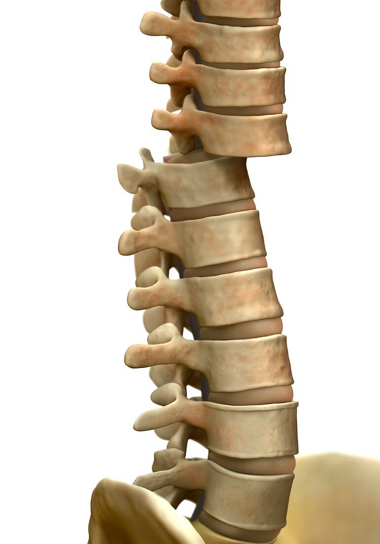 Broken backbone, illustration