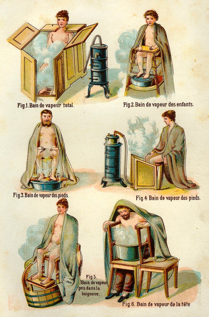 19th Century steam bath therapy, illustration