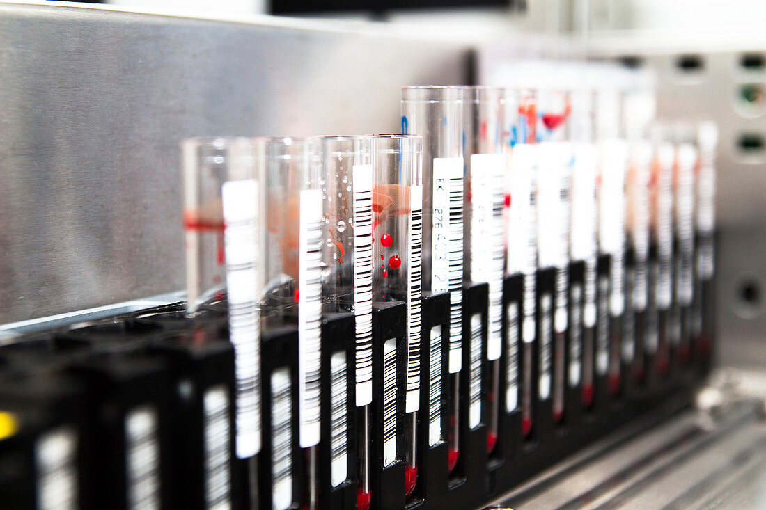 Blood sample analysis