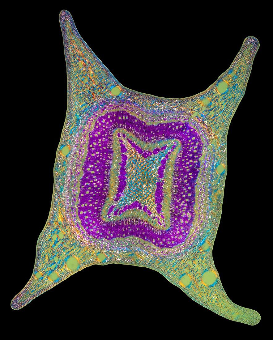 Tasmanian blue gum stem, polarised light micrograph