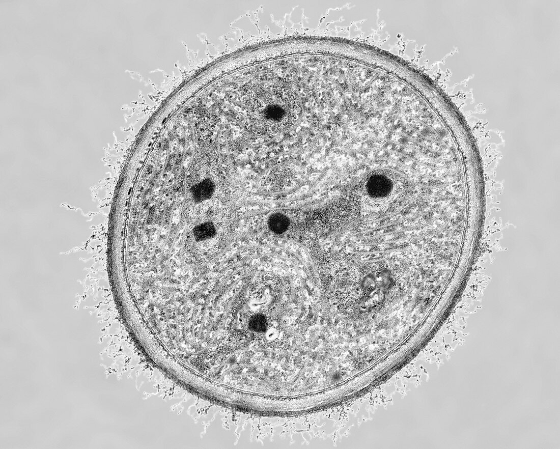 Cyanobacterium (Dermocarpa sp.), TEM