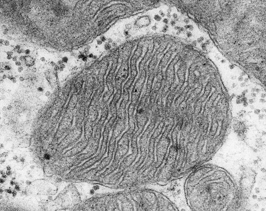 Mitochondrion from a heart muscle cell, TEM