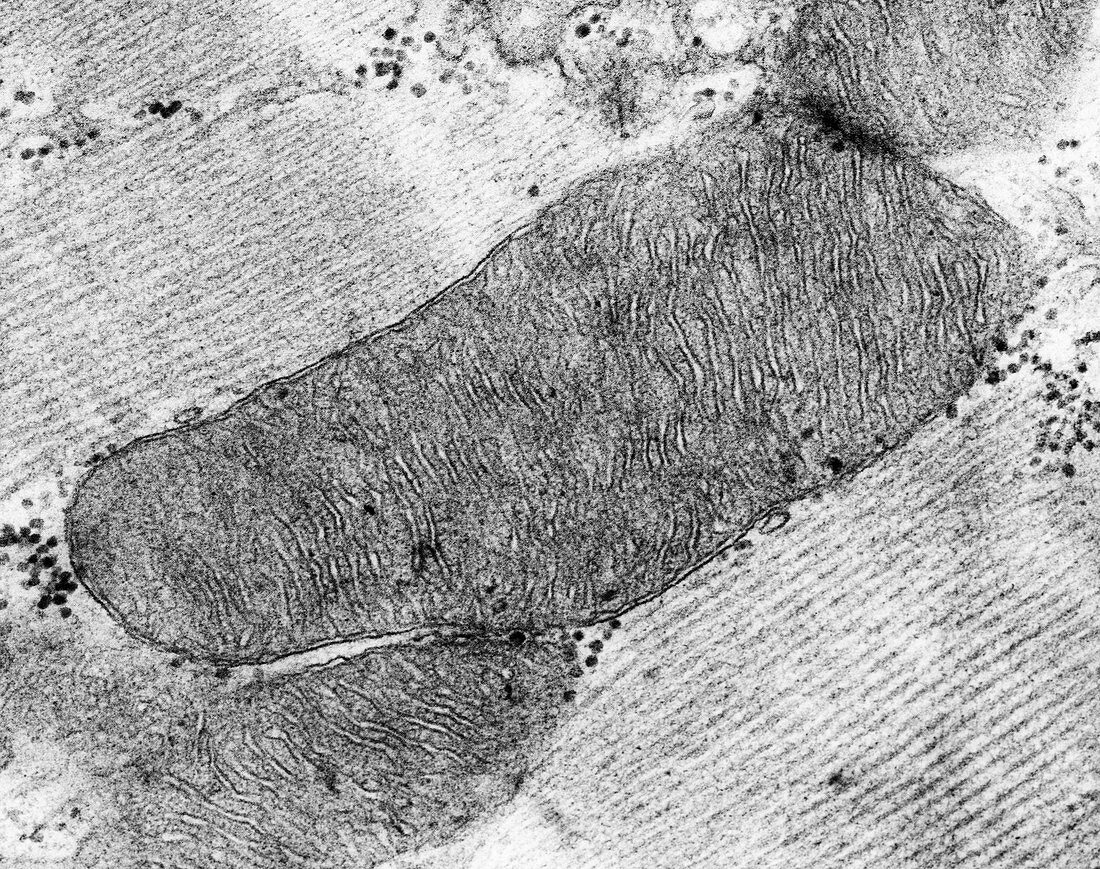 Mitochondrion from a heart muscle cell, TEM