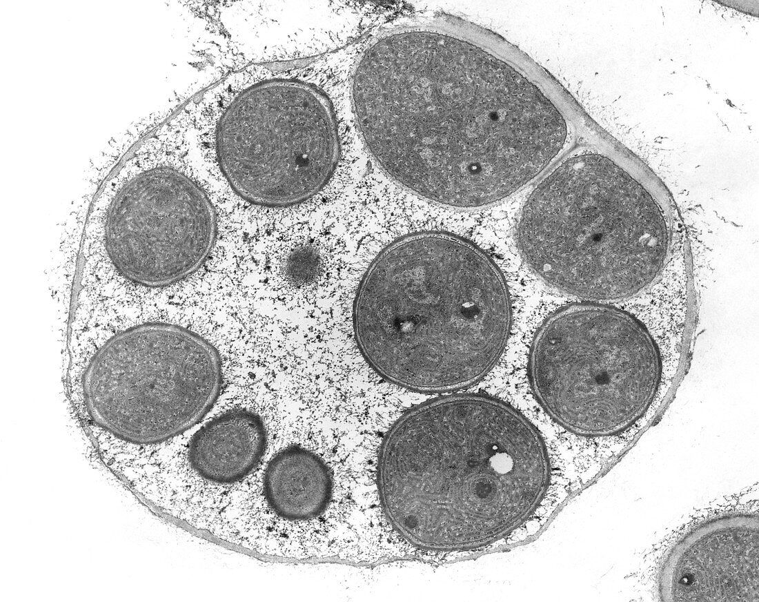 Cyanobacteria endospores (Dermocarpa sp.), TEM