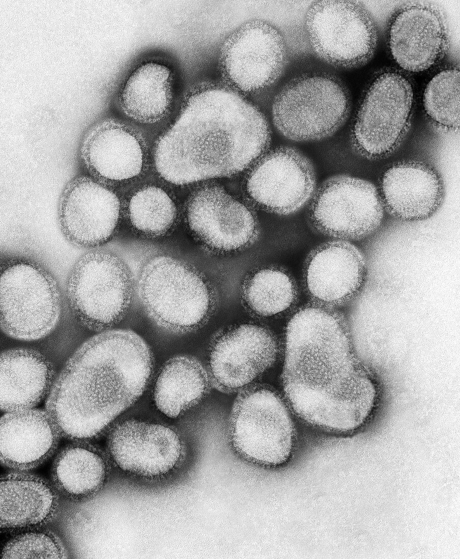 Human Swine Flu Virus H1N1, TEM