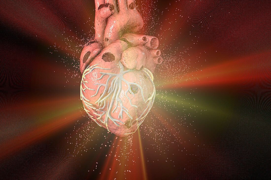 Heart destruction, conceptual illustration