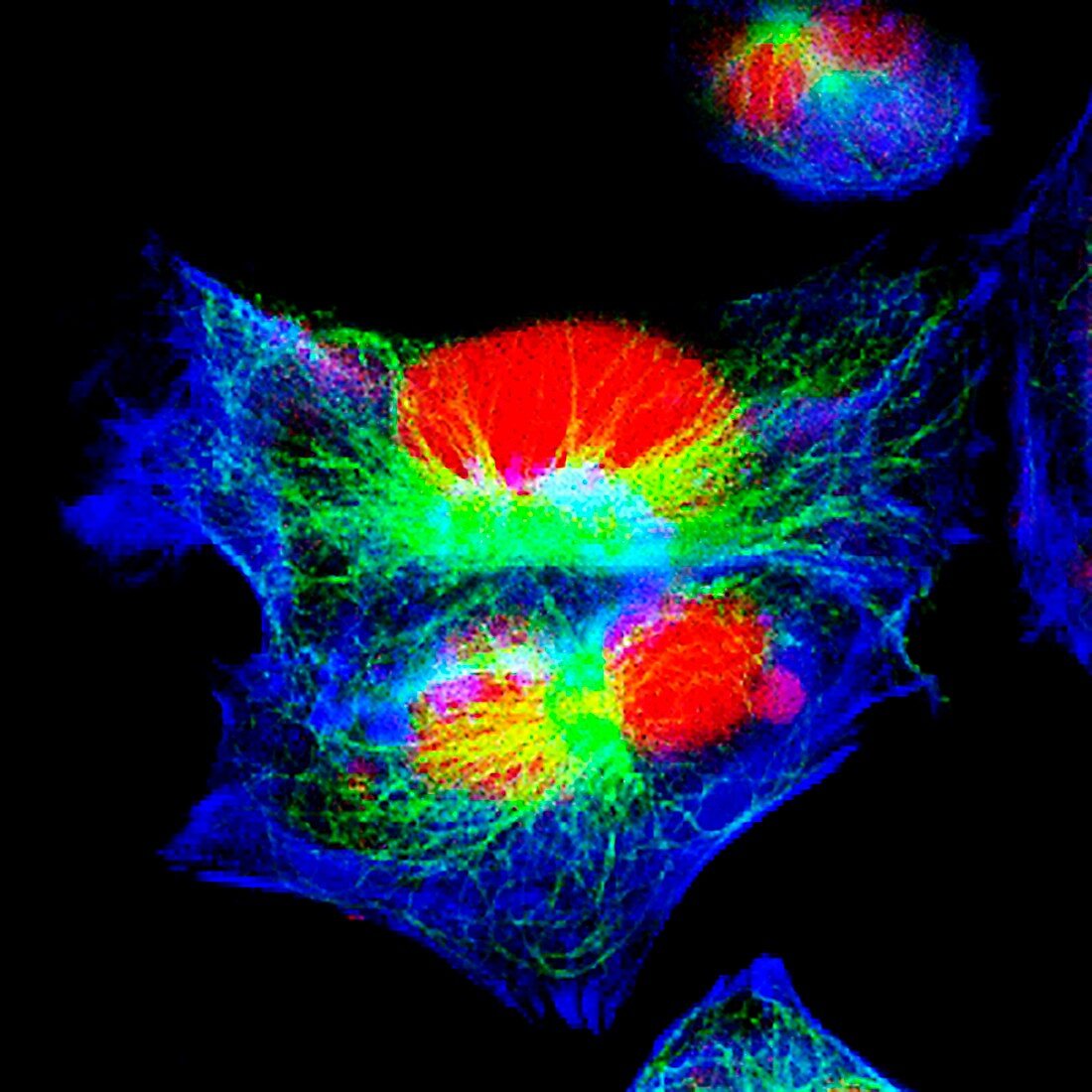 Neuroblastoma cells, fluorescence light micrograph