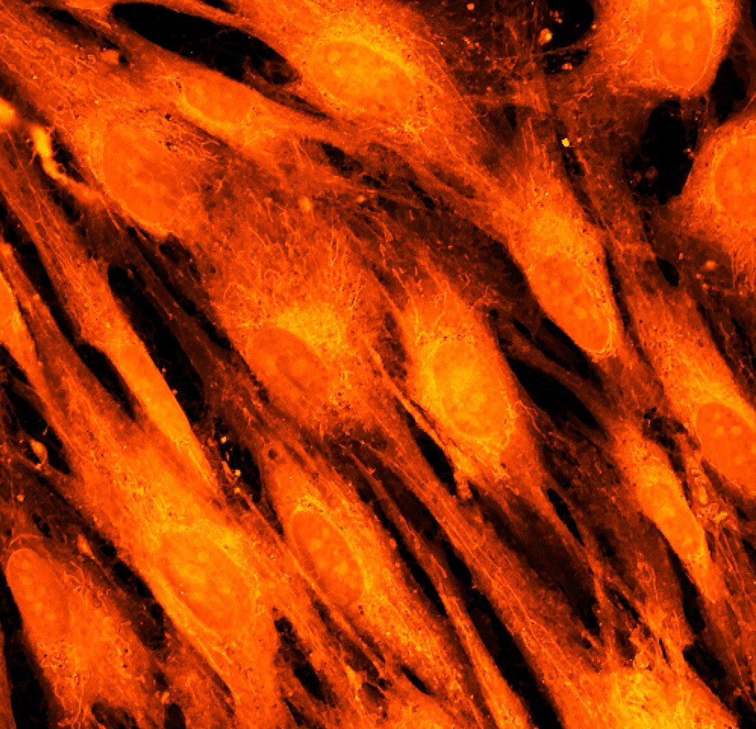 Fibroblast skin cells, fluorescence light micrograph