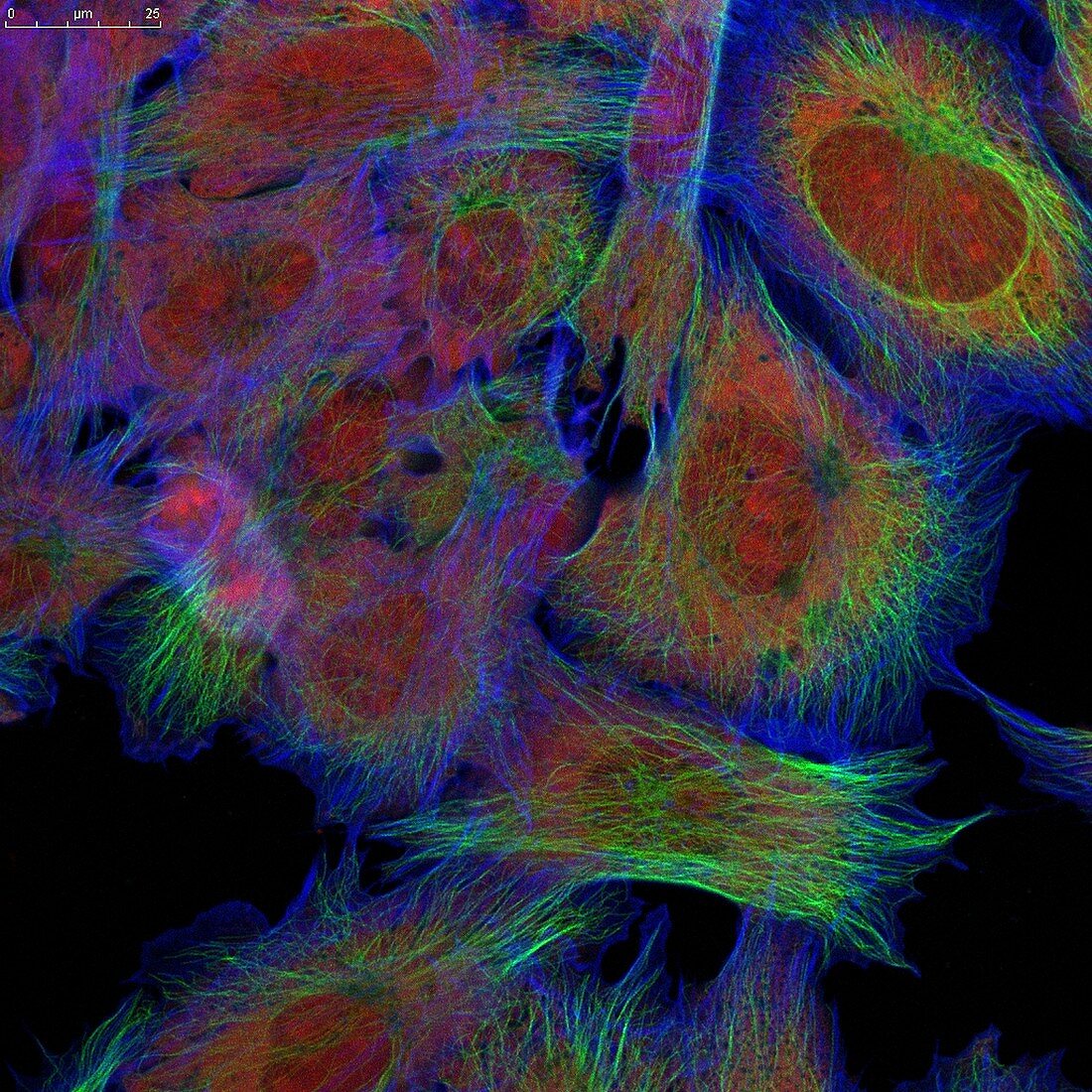 Fibroblast skin cells, fluorescence light micrograph