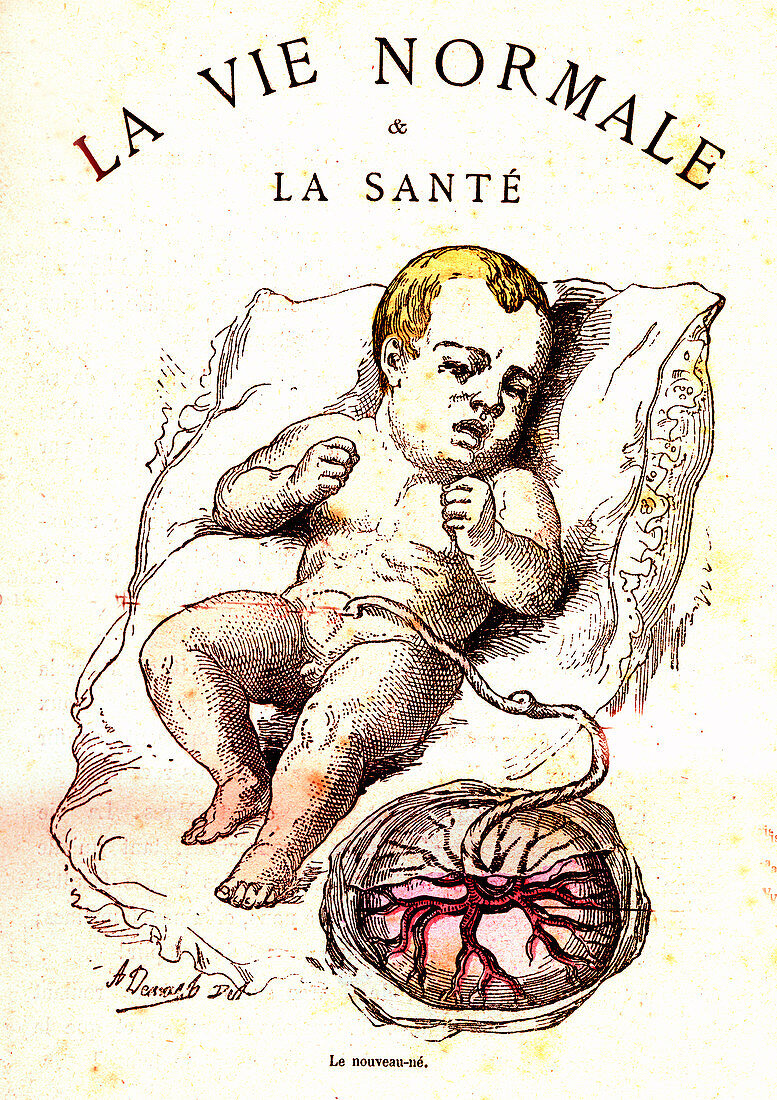 Baby and placenta, 19th Century illustration