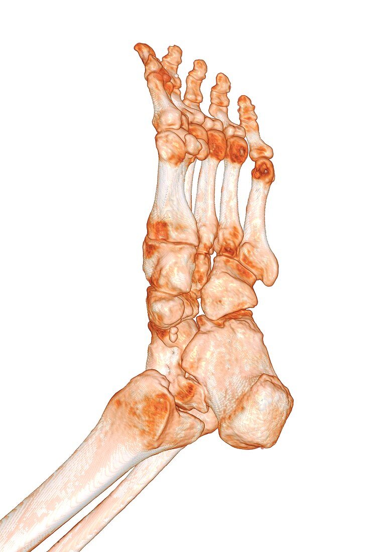 Human foot, 3D CT scan