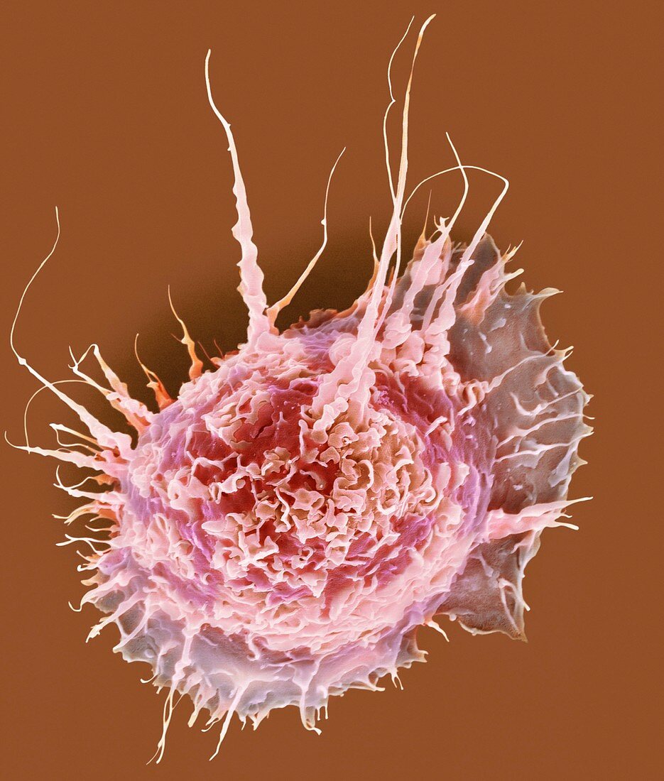 Alveolar macrophage, SEM