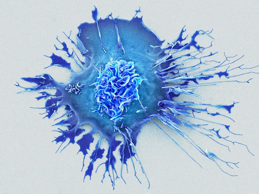 Human dendritic cell, SEM