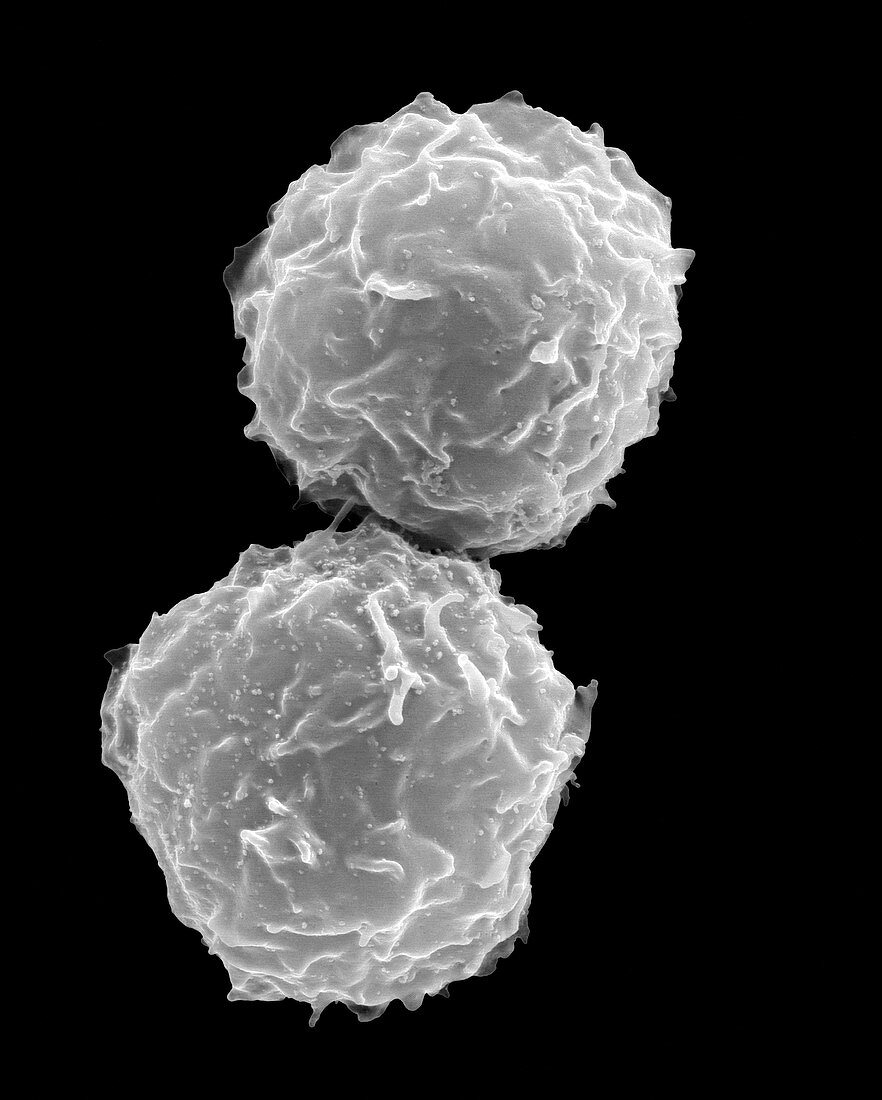 Human stem cells from bone marrow, SEM
