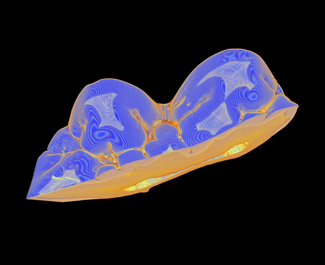 Pig tooth, micro-CT scan