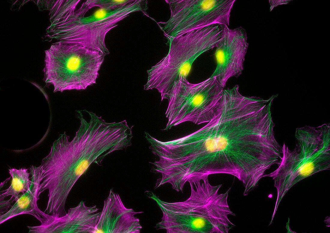 Osteoblast cells, fluorescence light micrograph