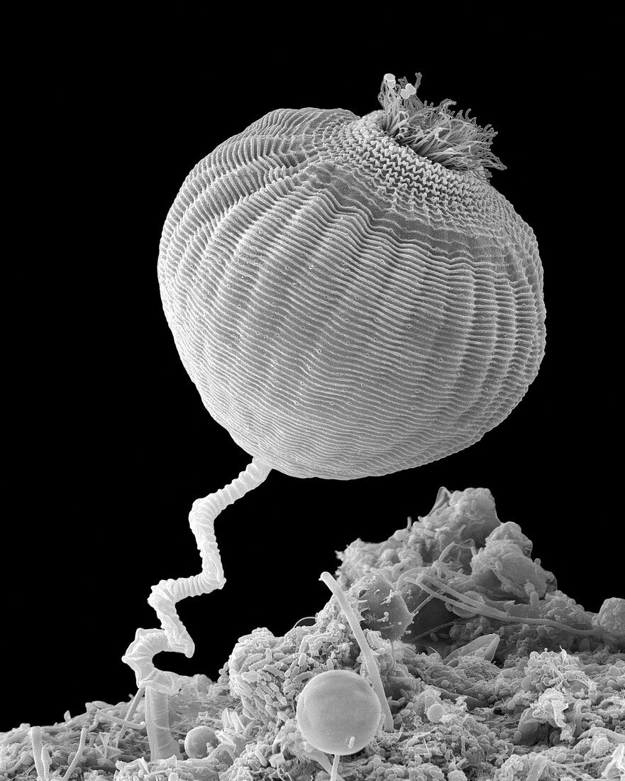 Protozoan (Vorticella sp.), SEM