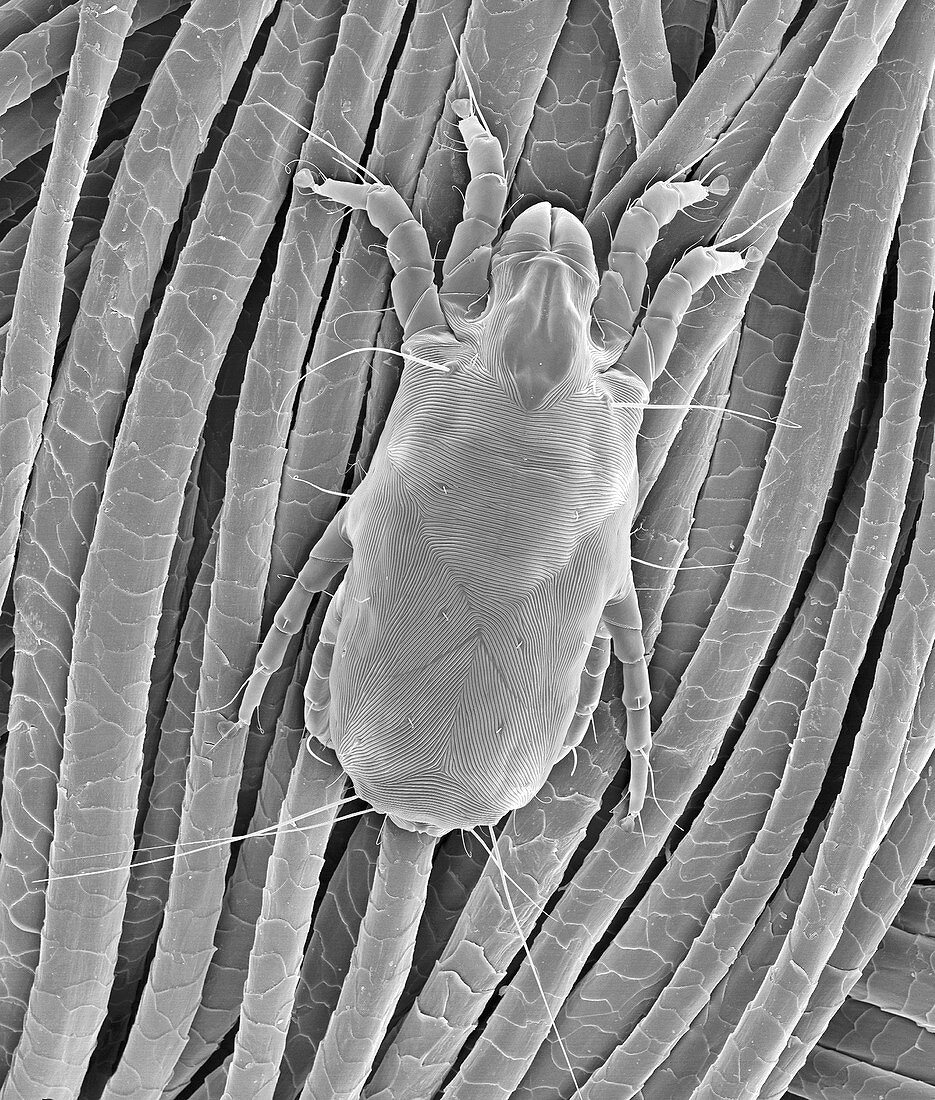 Dust mite on wool fabric, SEM