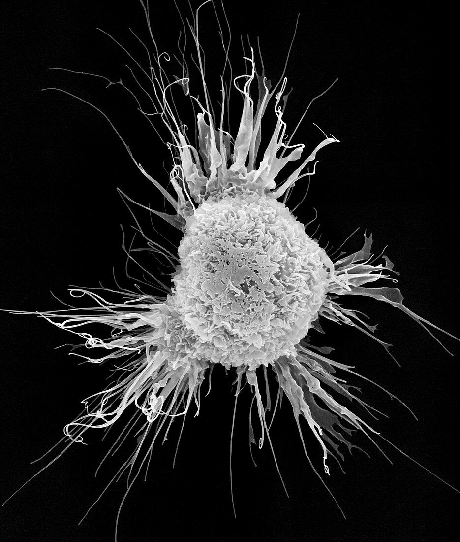 Mouse dendritic cell, SEM