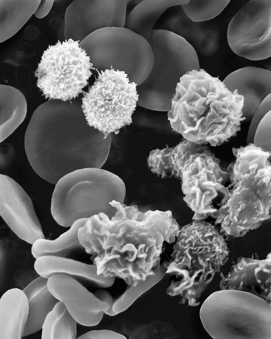 Macrophages, T lymphocytes and red blood cells, SEM