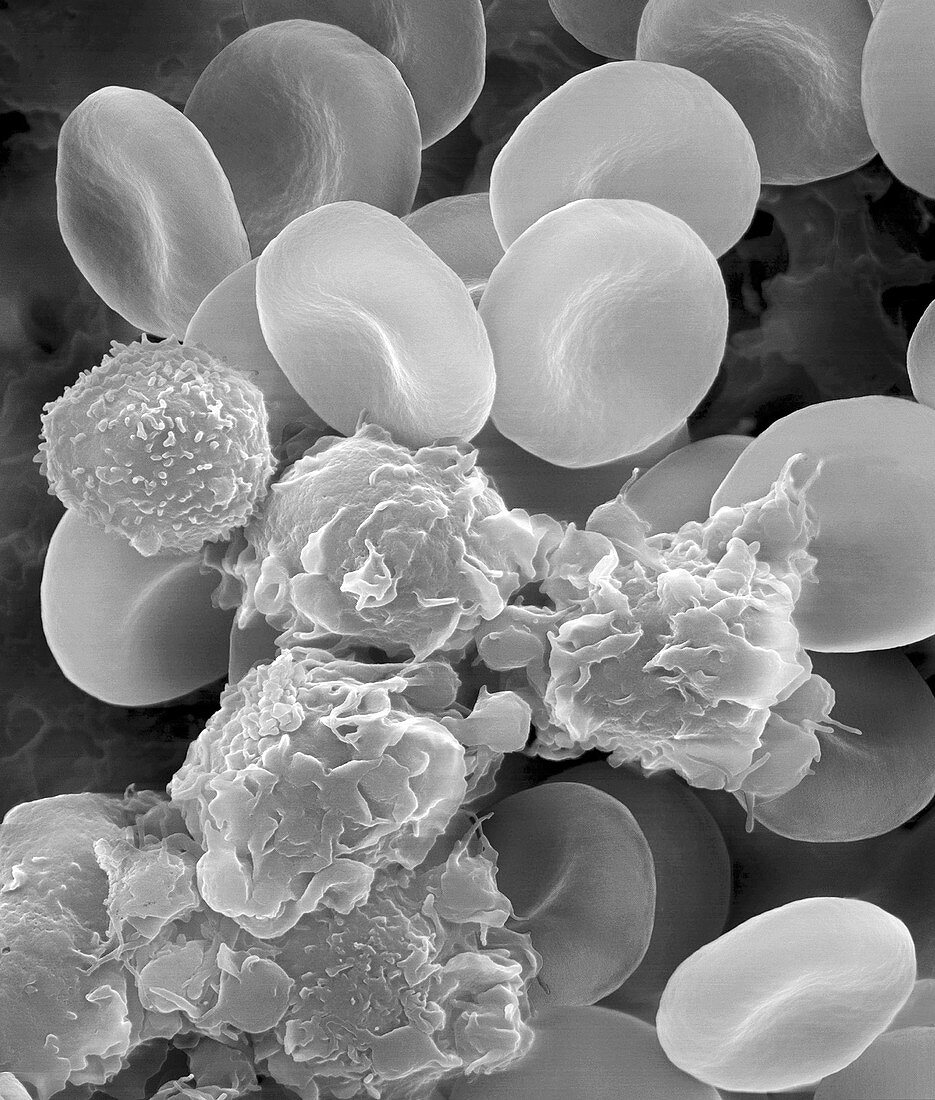 Human blood cells and activated platelets, SEM