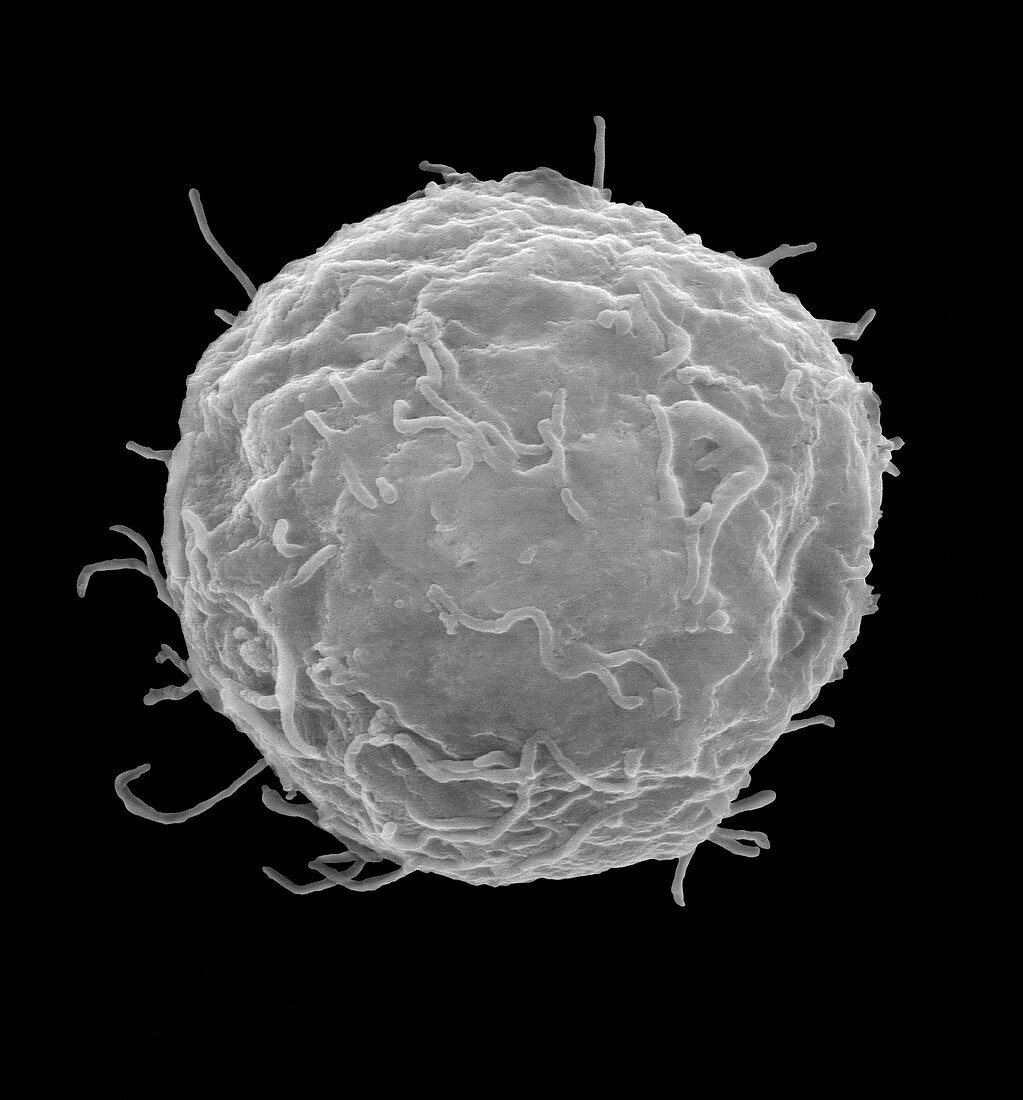 Stem cell isolated from cord blood, SEM