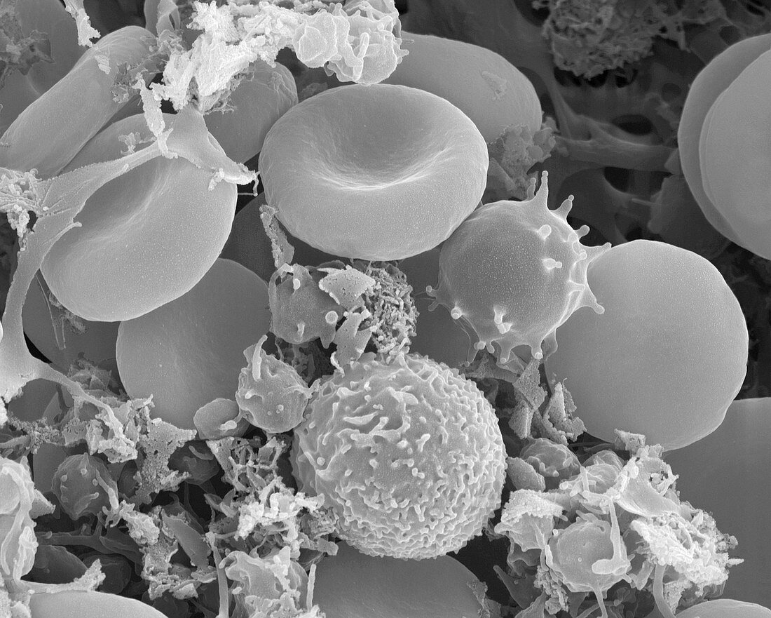 Human red and white blood cells, SEM