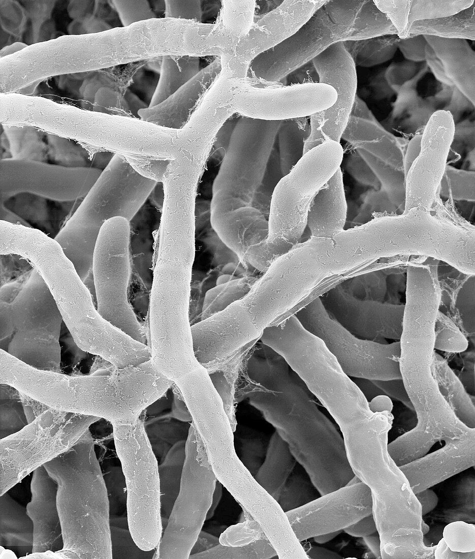 Rhizoctonia solani pathogenic plant fungus, SEM