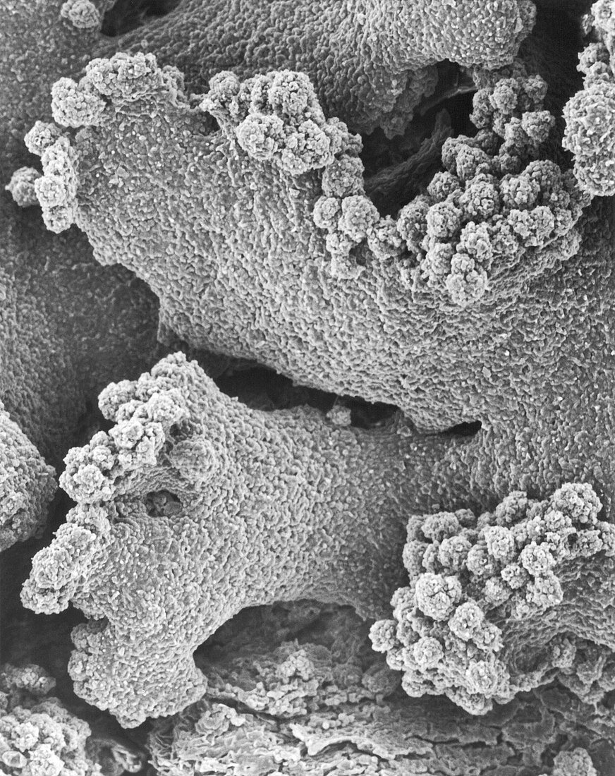 Crustose lichen Xanthomendoza fallax, SEM