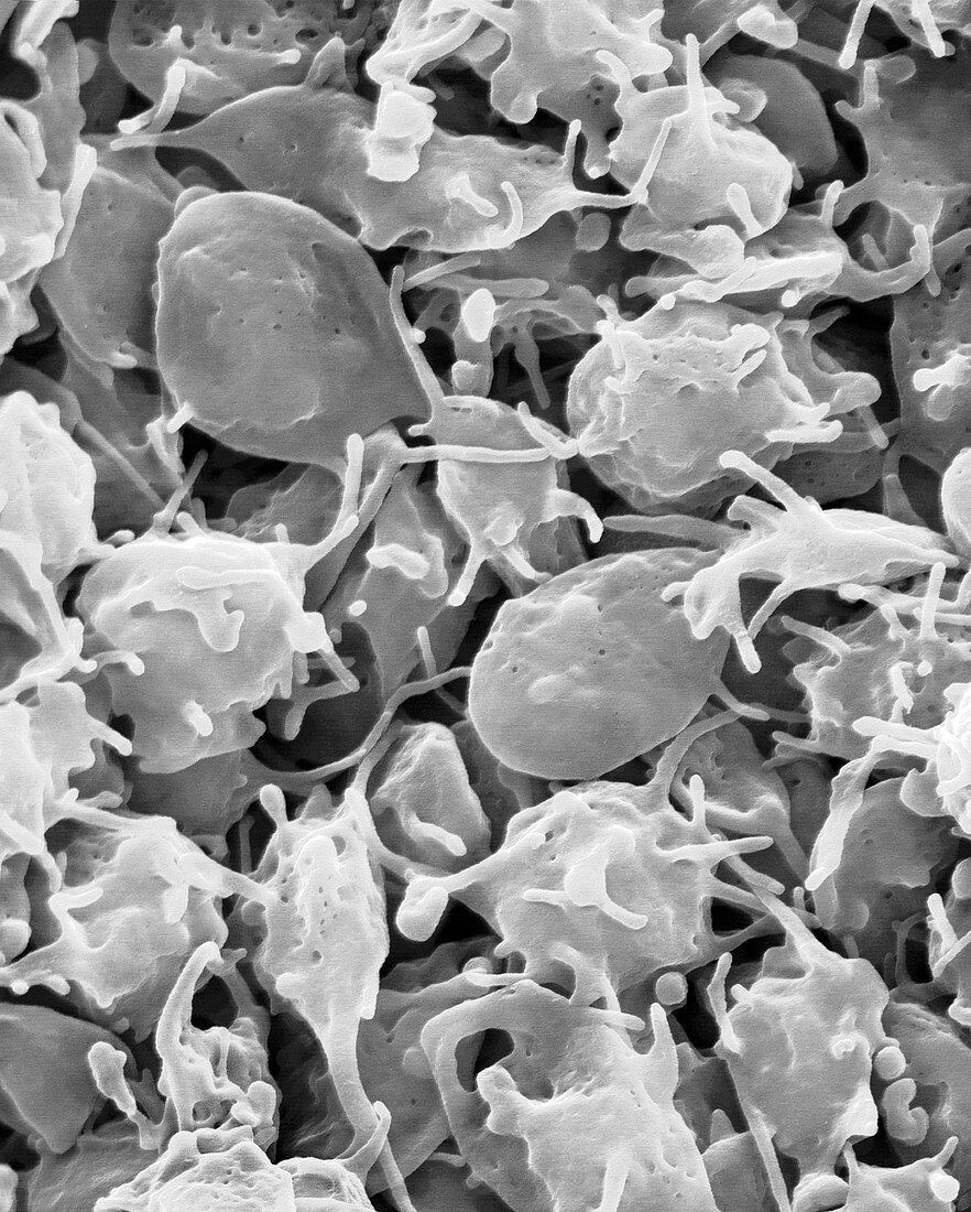 Activated platelets, SEM