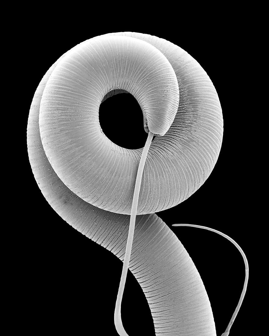 Nematode (Trichuris sp.) helminth (whipworm), SEM
