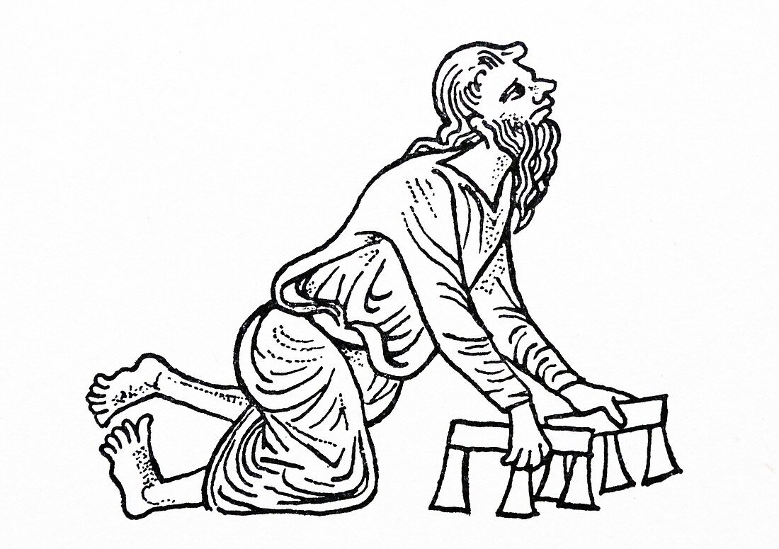 Man with a deformed foot, 14th century illustration