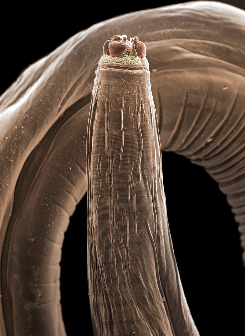 Parasitic roundworm, SEM