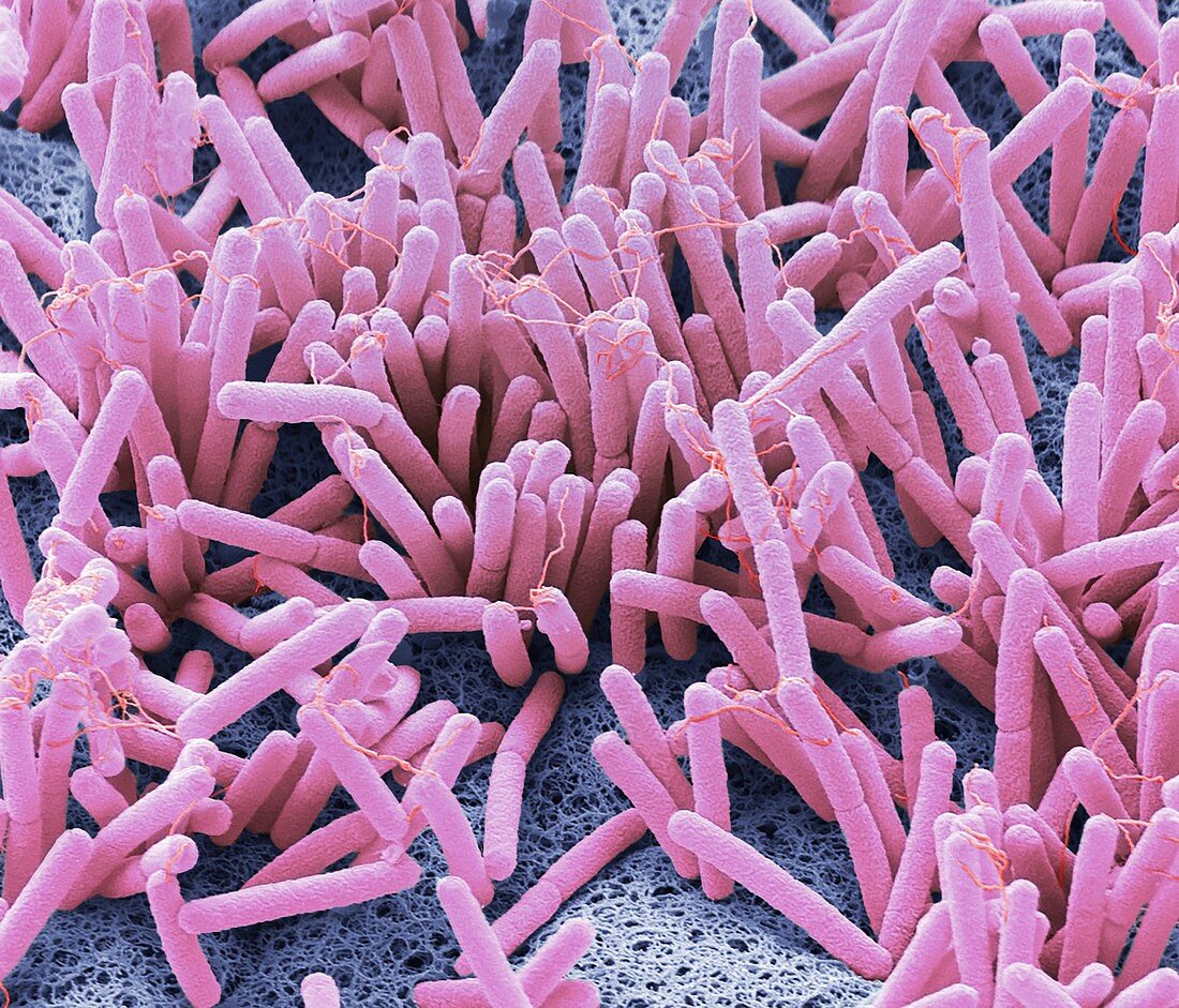 Penile bacteria, SEM